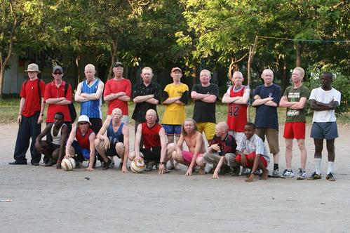 アルビノ黒人サッカーチーム01