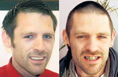 򥭥쥤ˤ̼ȷ뺧Ƥ⤤