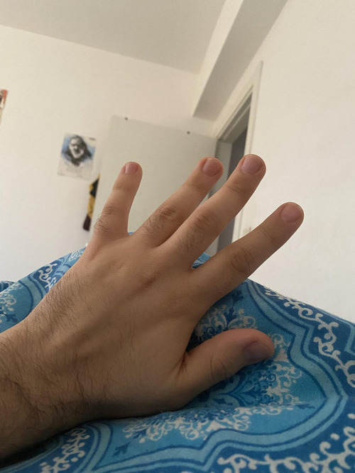 �ͤξ��ؤϥ��郎­��ʤ�04