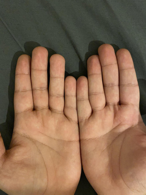 �ͤξ��ؤϥ��郎­��ʤ�02