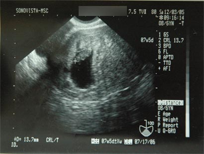 すくすく 05年12月