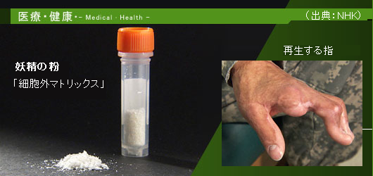 ここまで来た 再生医療 細胞外マトリックス と 幹細胞 利用 サイエンスジャーナル