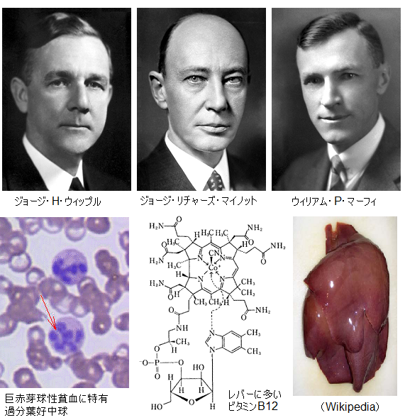 Whipple_Minot_Murphy