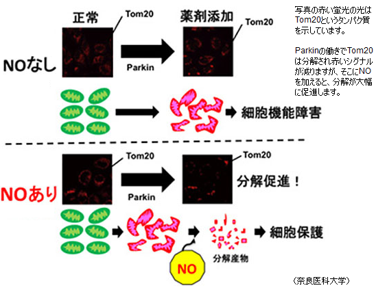 パーキンソン病治療に道 一酸化窒素の改善 抑制効果 サイエンスジャーナル