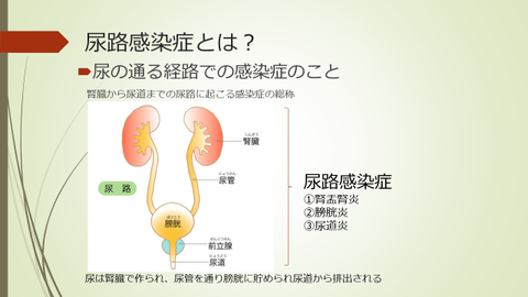 尿路感染症にフルコナゾールを服用するにはどうすればよいですか?