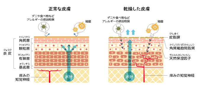 蟾ョ縺玲崛縺育畑繧、繝ゥ繧ケ繝・md02_q1_1_2_img1@2x