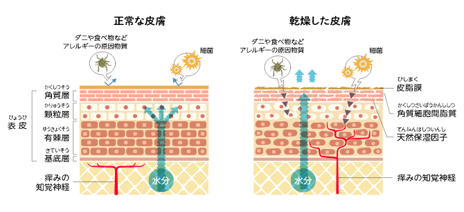 蟾ｮ縺玲崛縺育畑繧､繝ｩ繧ｹ繝・md02_q1_1_2_img1@2x