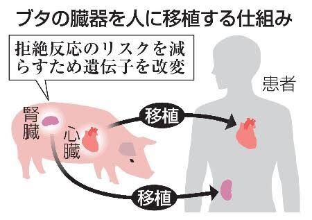 腎臓移植を受けた人の余命は何年ですか?