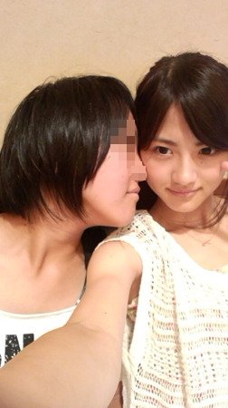 乃木坂46若月佑美のガチ整形 手術直後の画像流出 微グロ注意 Gラボ Akb48 乃木坂46若月佑美のガチ整形 手術直後の画像流出 微グロ注意 Gラボ Akb48