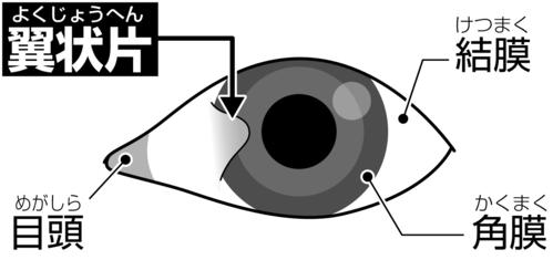 202401100000386-w500_17