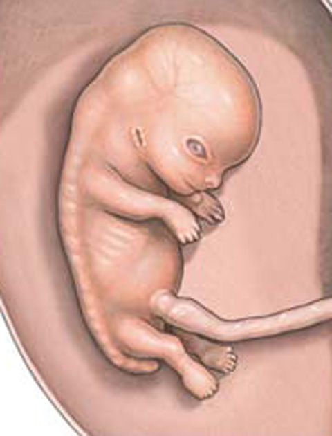 85-week-fetus