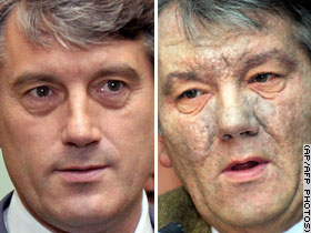 yushchenko