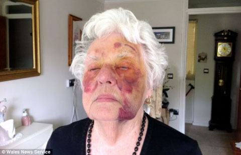 article-2458553-18BA405600000578-524_634x409