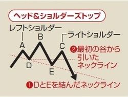 ヘッド・アンド・ショルダーズ