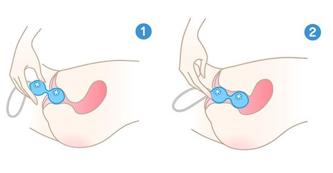 LCインナーボール2