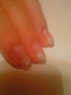 Lotton ジェルネイルアレルギー