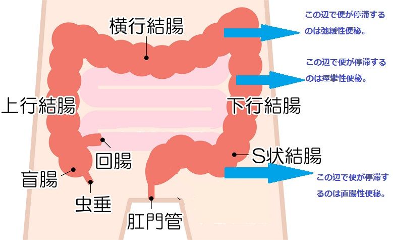 ない ある 出 便意 の に が