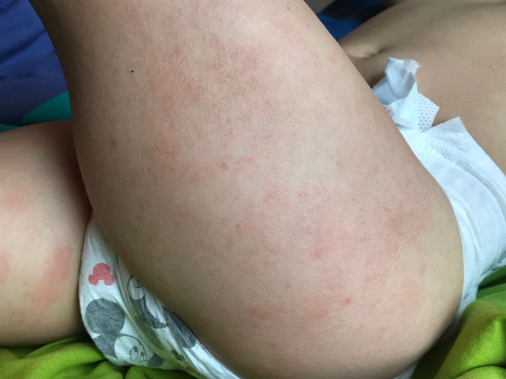 モントリオール生活 三男 2 歳9ヶ月の成長 アトピー症状 初めて自分の名前を言う 初めてのトイレ モントリオール生活 三男 2 歳9ヶ月の成長 アトピー症状 初めて自分の名前を言う 初めてのトイレ