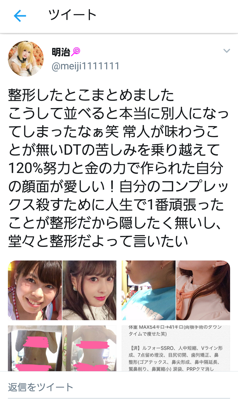 700万円使って全身整形した女さん 現るwwwwwwwwwwwwwwwwww まとめてんじぇい なんjまとめ