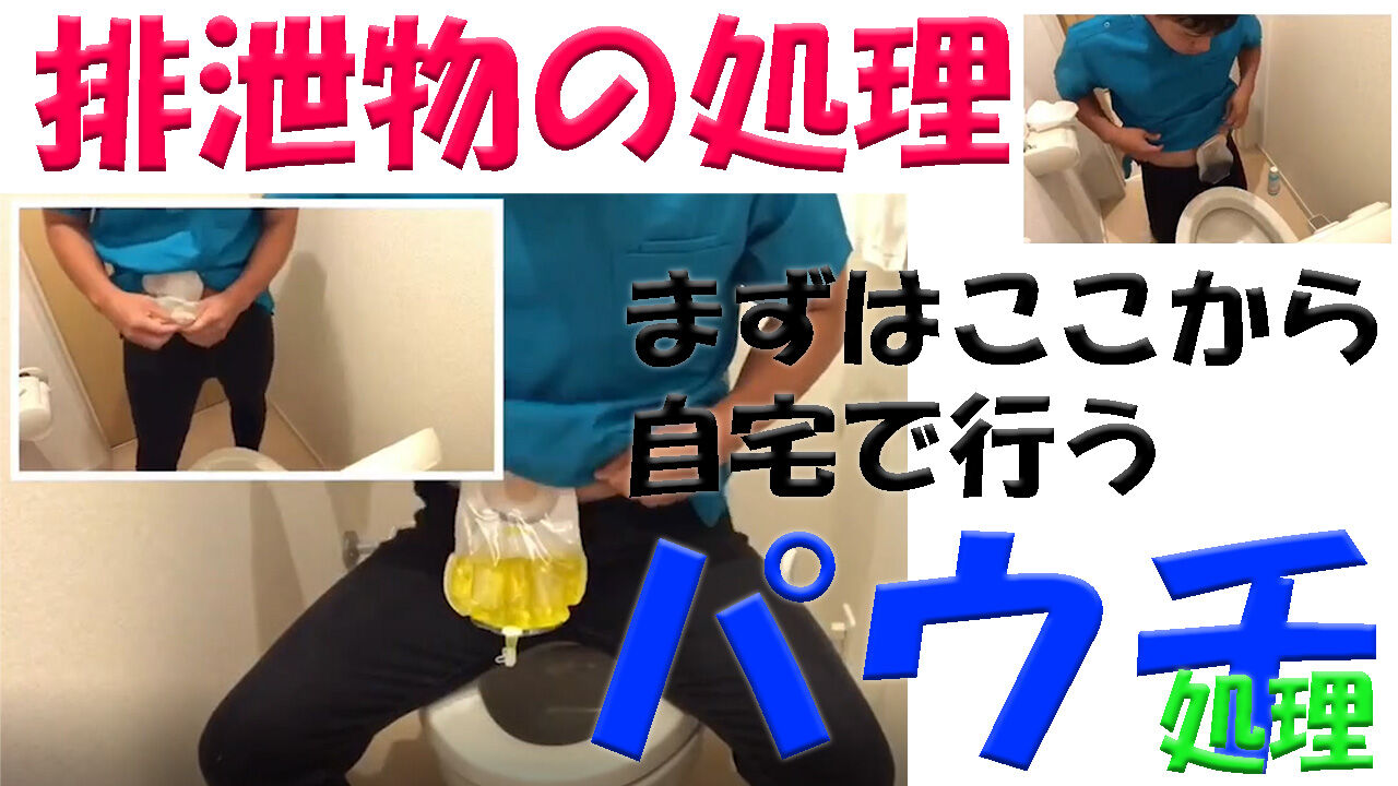 自宅での排泄物の処理方法 パウチ処理 オストメイトの情報発信メディア オスとぴ 自宅での排泄物の処理方法 パウチ処理 オストメイトの情報発信メディア オスとぴ