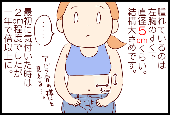 レントゲン01