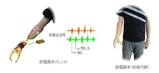 パラ 最新の義手 かっこいい ゲーハーの窓