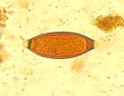 Trichuris t