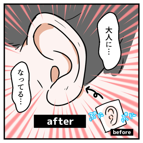 耳垢ごっそり(2)_出力_009