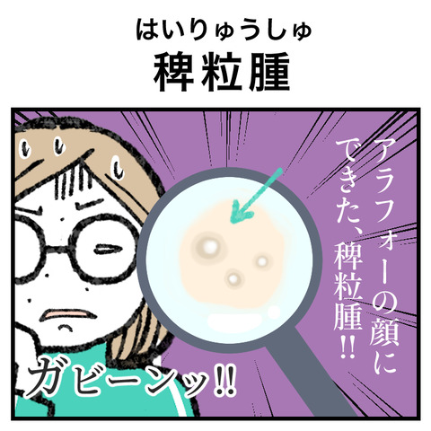稗粒腫(はいりゅうしゅ)_001