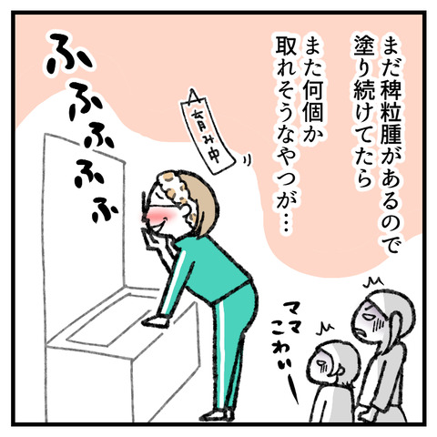 稗粒腫(はいりゅうしゅ)_003