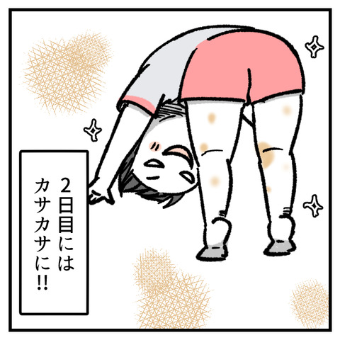 とびひが最大◯cmになった(3)_出力_008