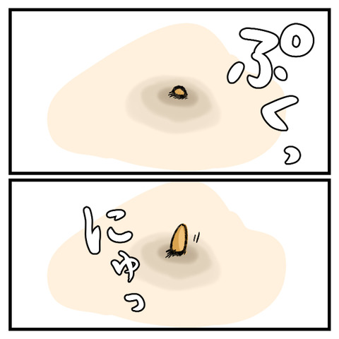 稗粒腫(はいりゅうしゅ)_004