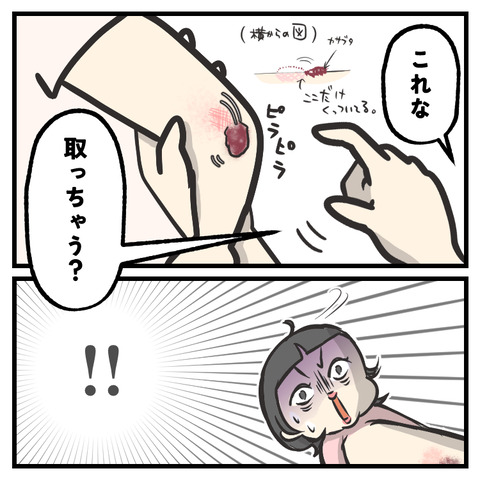 5歳のかさぶた_出力_003