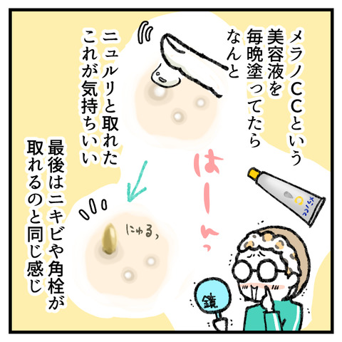 稗粒腫(はいりゅうしゅ)_002