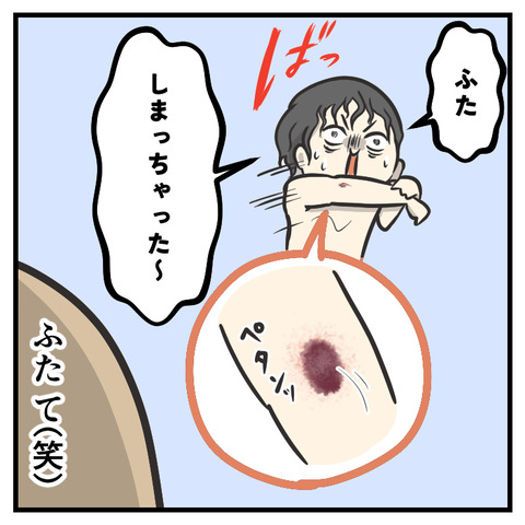 5歳のかさぶた_出力_007