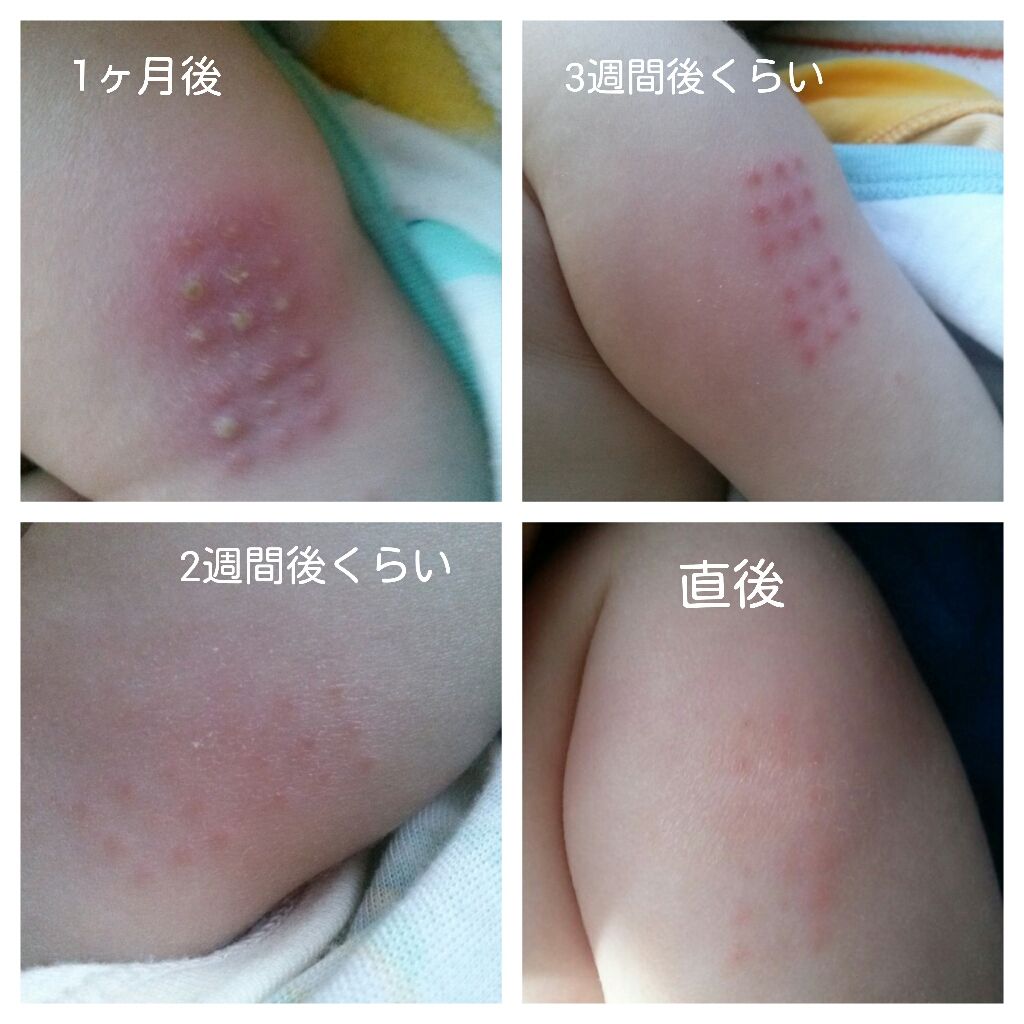 g接種経過 ほどほど録 g接種経過 ほどほど録
