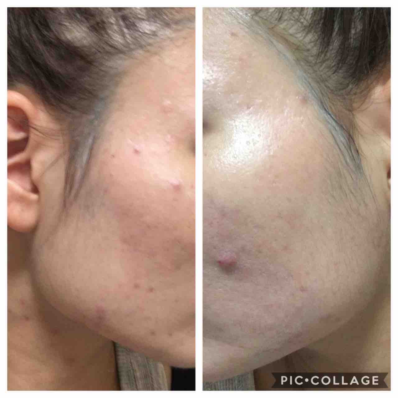 クロロフィル2ヶ月目 美人になりたいおデブスブログ