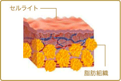 spec11_1