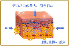 spec11_3