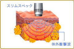 spec11_2