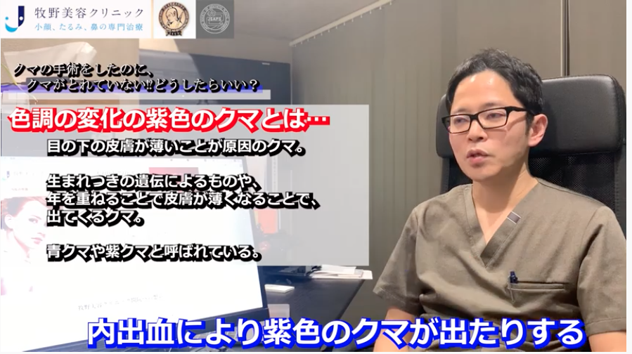 動画コンテンツ 目の下のクマ 美容形成外科医dr 牧野のblog