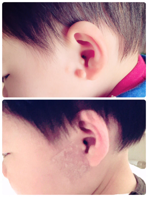 ear