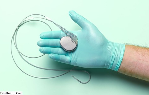 ペースメーカー本体