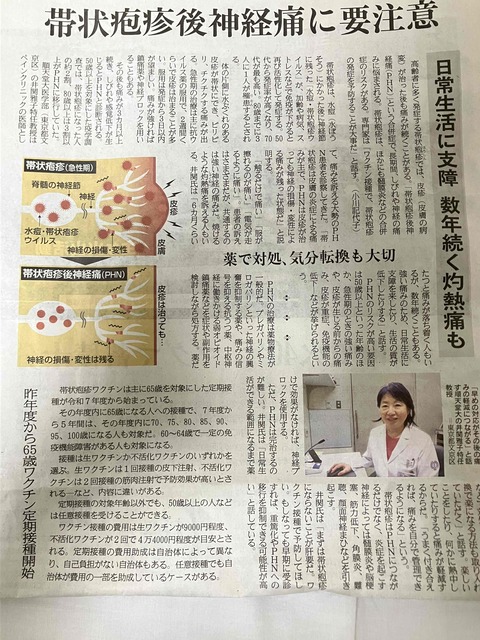 帯状疱疹