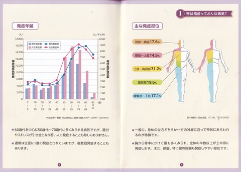 帯状疱疹