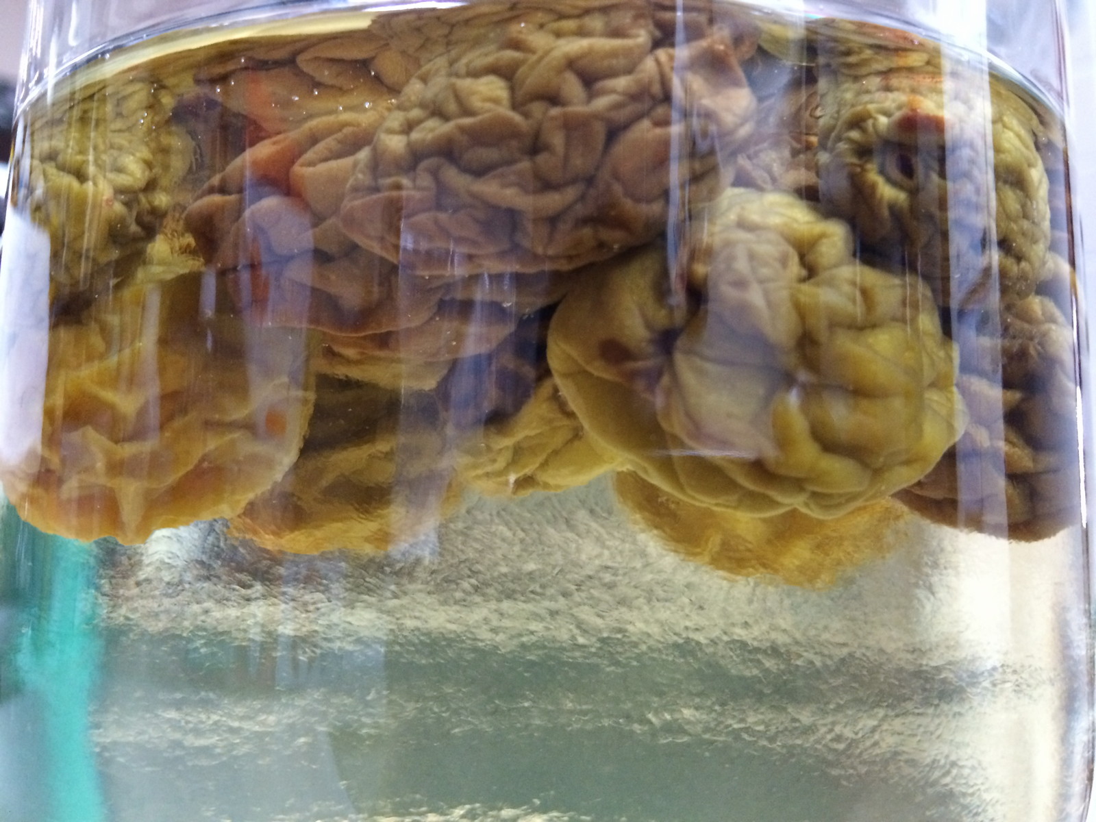 梅シロップしわしわ マンボな毎日