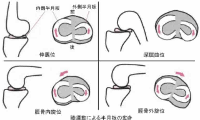 半月板損傷でした 明日は明日の風が吹く 半月板損傷でした 明日は明日の風が吹く