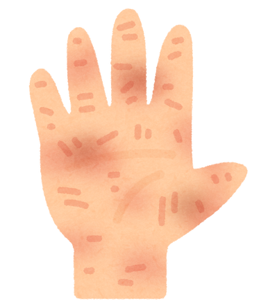 body_hand_areru