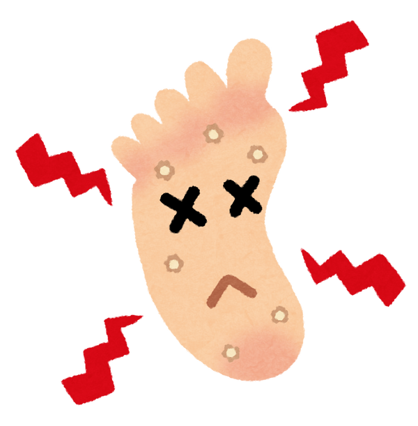 foot_sick_uonome_tako