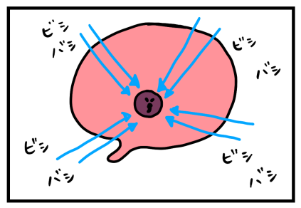 脳腫瘍について1-3